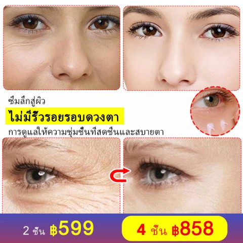 แอสตาแซนธิน คาเวียร์ ครีมบำรุงรอบดวงตา- เลือนริ้วรอยรอบดวงตา/รอยคล้ำ/ถุงใต้ตา