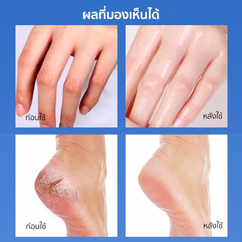 วาสลีน พีช มอยเจอร์ไรซิ่ง สติ๊ก - กำจัดข้อต่อมือและเท้าที่แตก/ลอก/ดำ