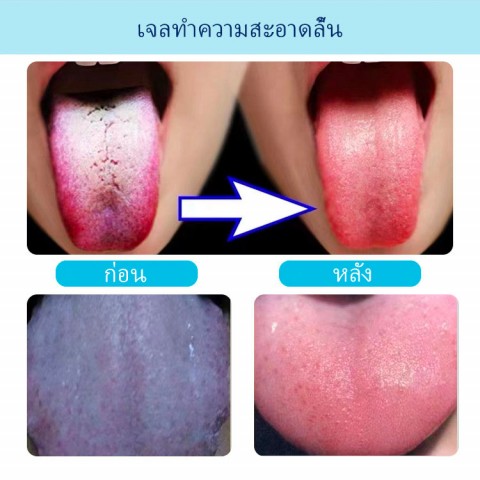 พร้อมแปรง - ลดกลิ่นปาก แปรงอนามัยช่องปากเพื่อสุขภาพ - สำหรับผู้ใหญ่และเด็ก